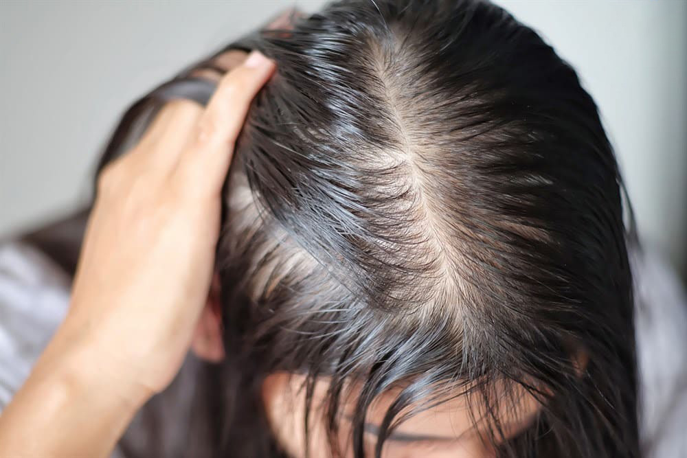 Tại sao tóc của bạn bị khô xơ  Vinmec